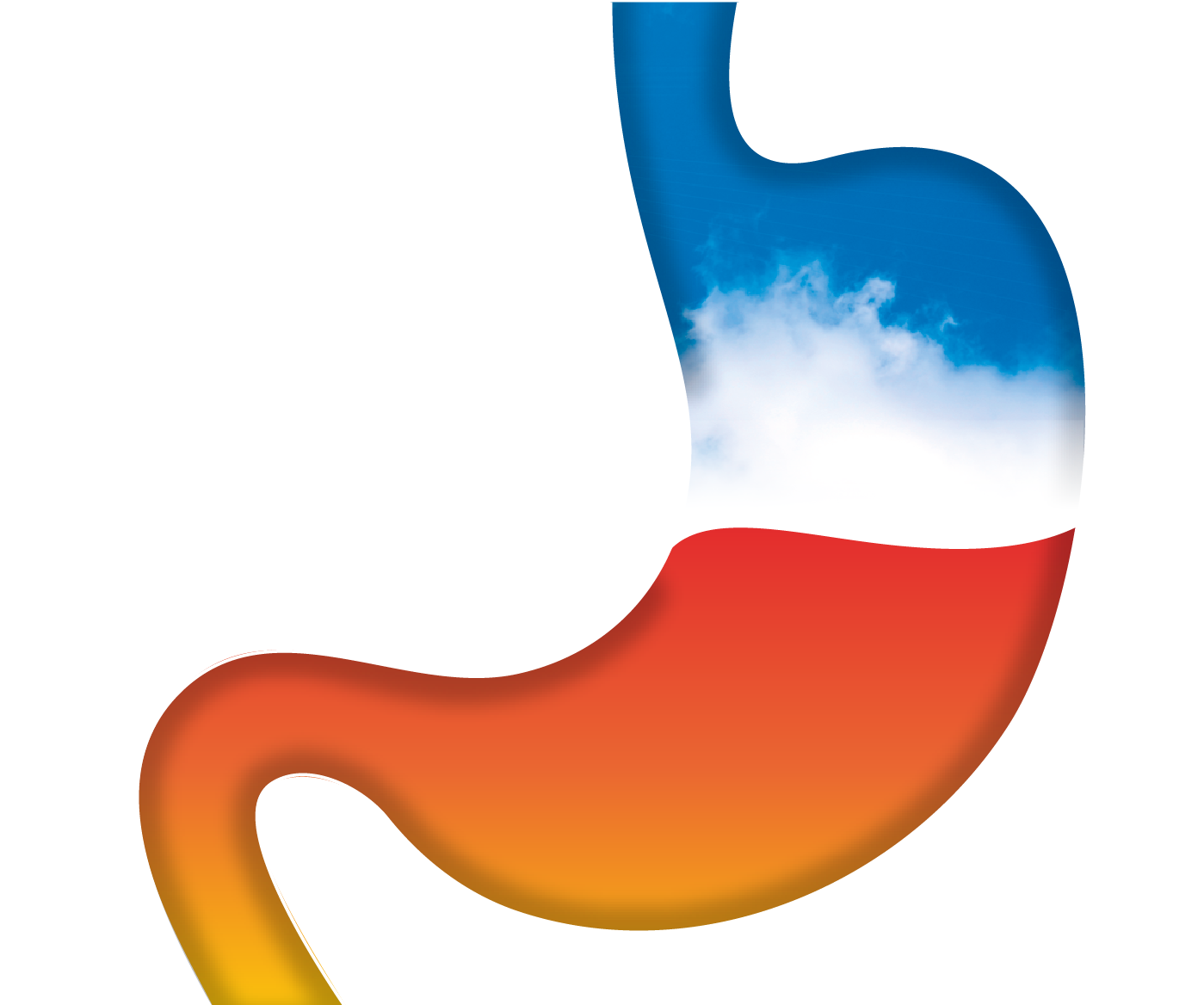 Reflusso gastrico